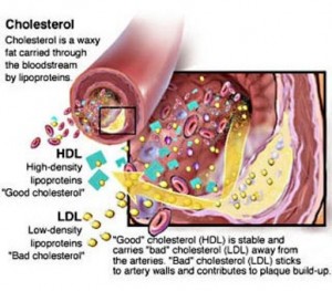 Cholesterol-Range